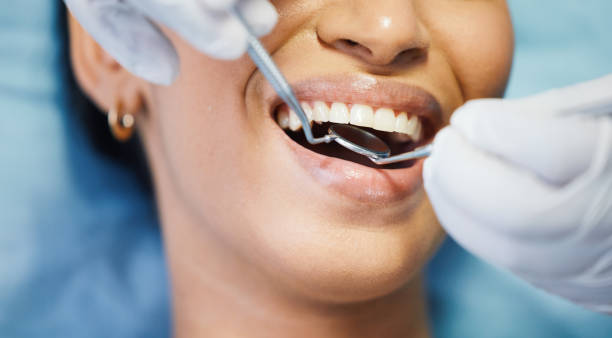 Best Chipped Tooth Repair Near Me  in East Point, GA