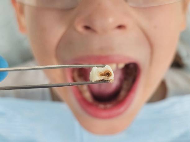 Best Urgent Tooth Repair  in East Point, GA