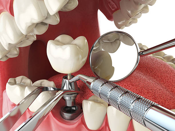 Best Tooth Pain Emergency Relief  in East Point, GA